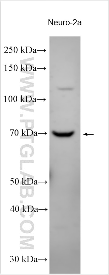 Immunoprecipitation (IP) experiment of Neuro-2a cells using NBPF3 Polyclonal antibody (17606-1-AP)