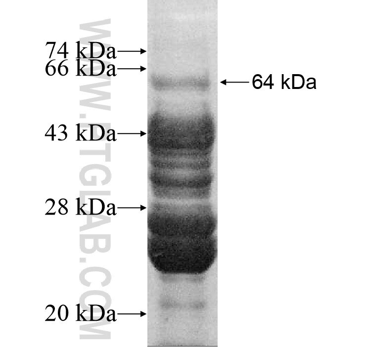 NBPF3 fusion protein Ag11749 SDS-PAGE