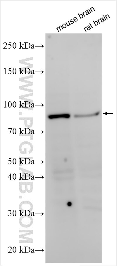 Western Blot (WB) analysis of various lysates using NBPF4-Specific Polyclonal antibody (20099-1-AP)