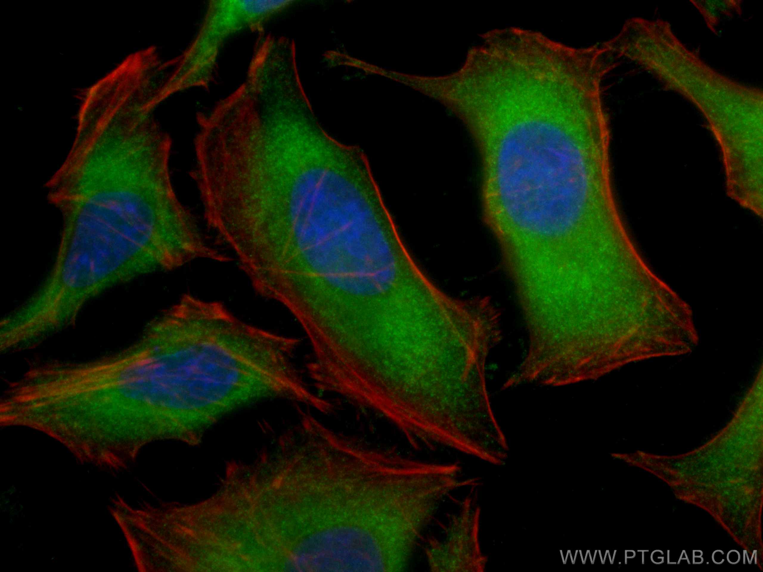 Immunofluorescence (IF) / fluorescent staining of HeLa cells using NBR1 Polyclonal antibody (16004-1-AP)
