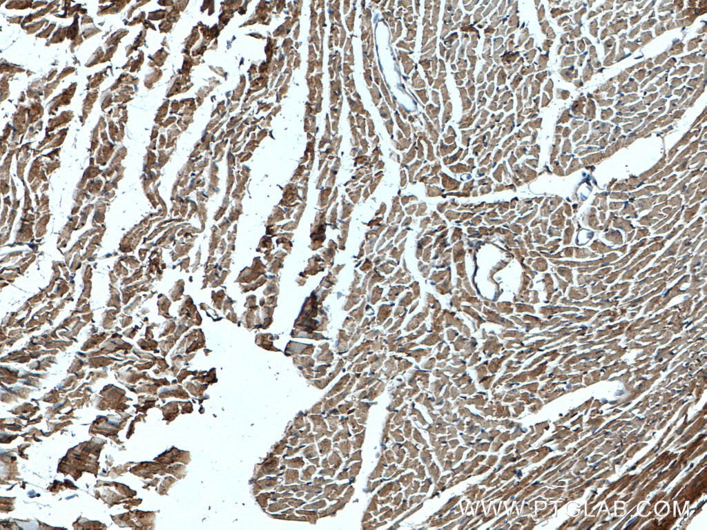 Immunohistochemistry (IHC) staining of mouse heart tissue using NBR1 Polyclonal antibody (16004-1-AP)