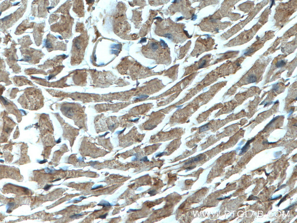 Immunohistochemistry (IHC) staining of mouse heart tissue using NBR1 Polyclonal antibody (16004-1-AP)
