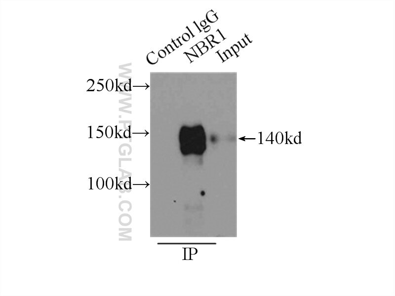 Immunoprecipitation (IP) experiment of HeLa cells using NBR1 Polyclonal antibody (16004-1-AP)