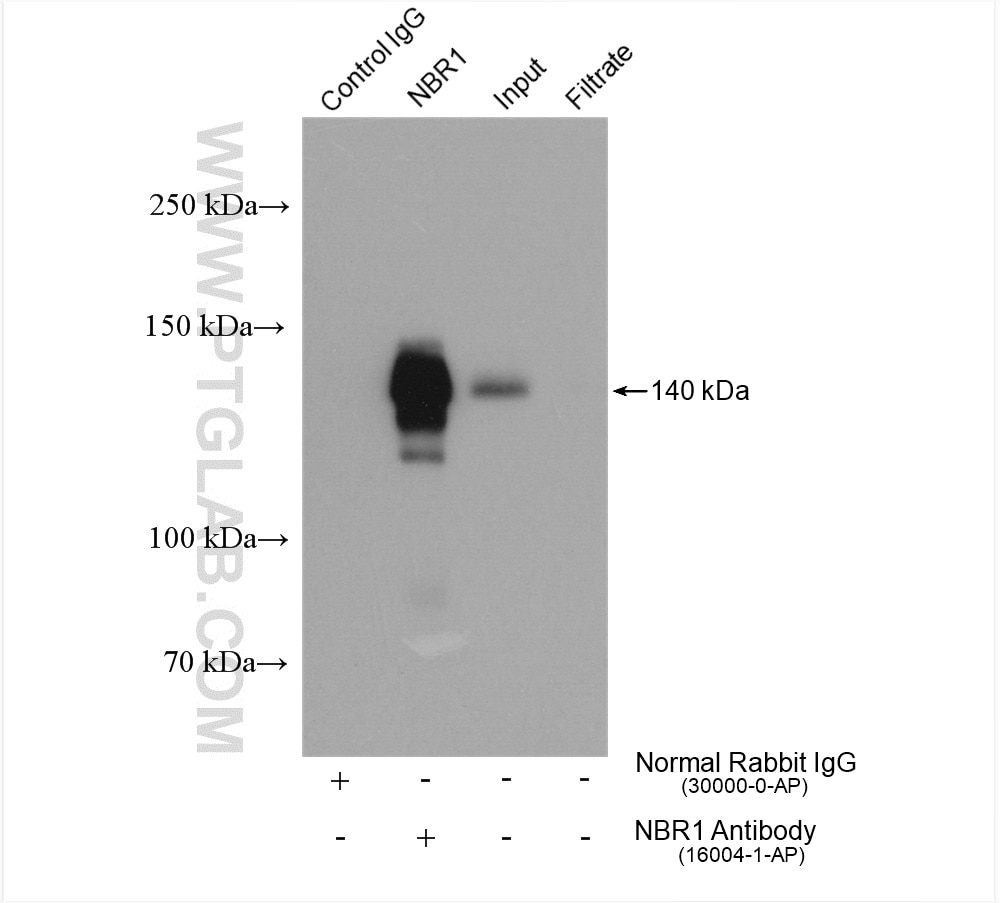 Immunoprecipitation (IP) experiment of HeLa cells using NBR1 Polyclonal antibody (16004-1-AP)