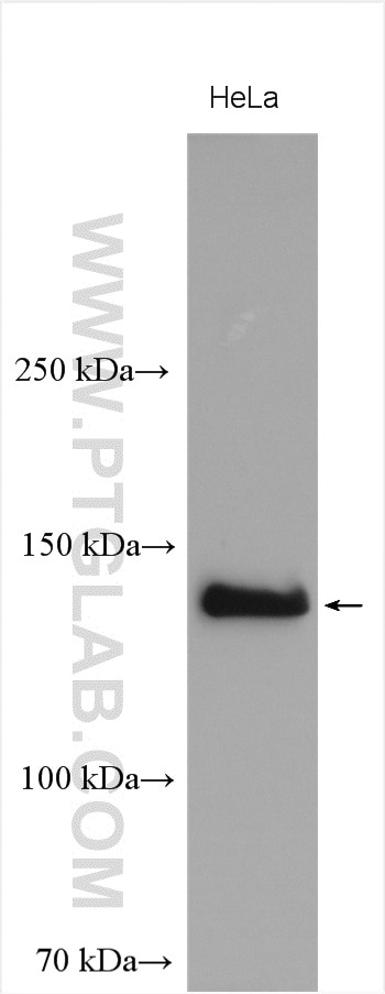 Western Blot (WB) analysis of various lysates using NBR1 Polyclonal antibody (16004-1-AP)