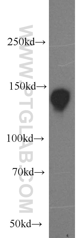 NBR1 Polyclonal antibody