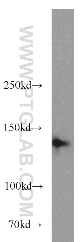 Western Blot (WB) analysis of HepG2 cells using NBR1 Polyclonal antibody (16004-1-AP)