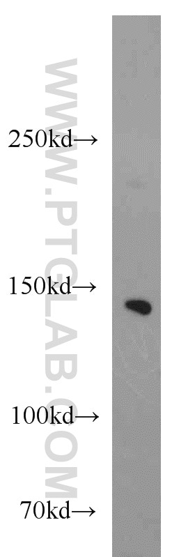 Western Blot (WB) analysis of COS-7 cells using NBR1 Polyclonal antibody (16004-1-AP)