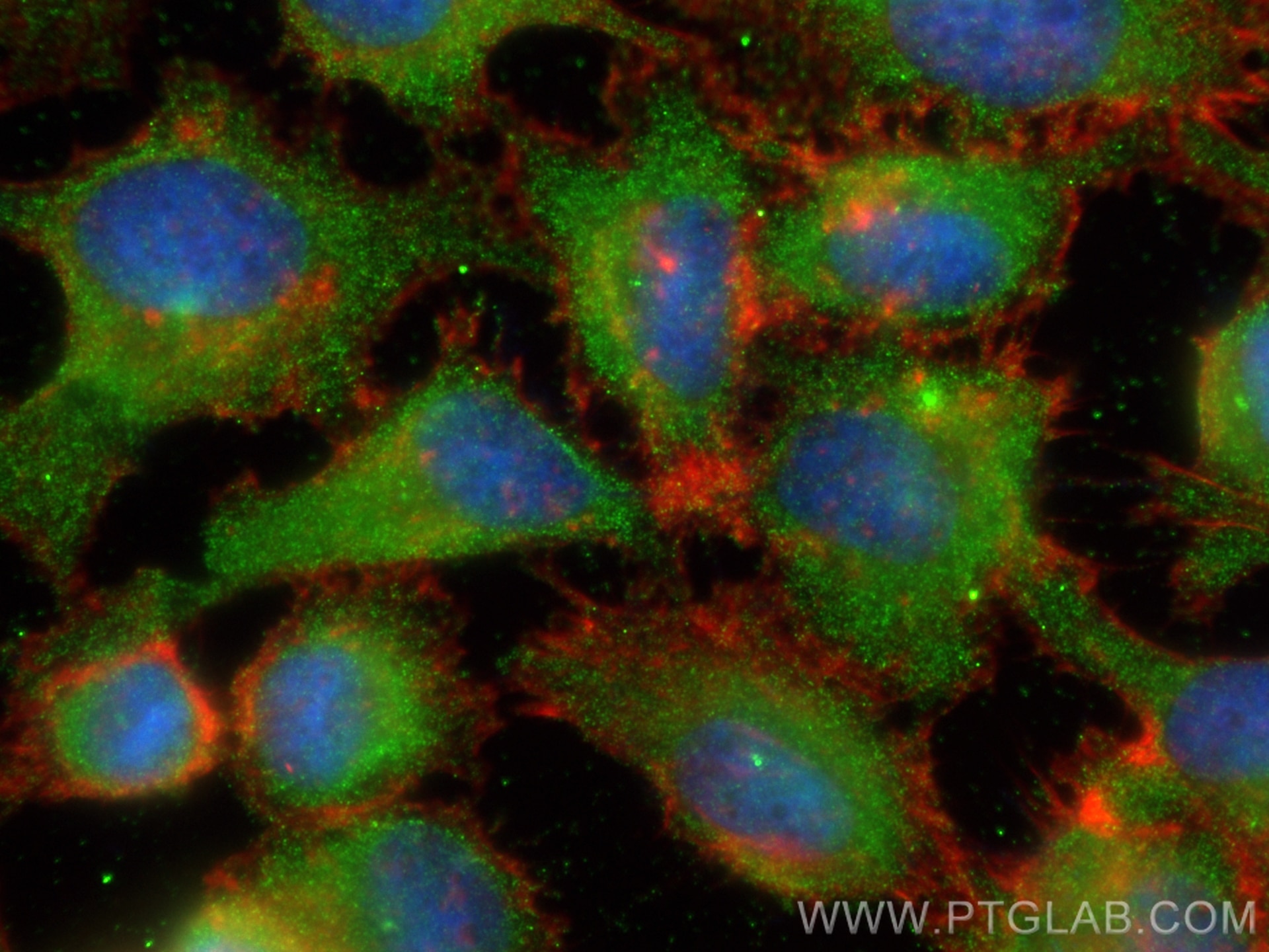 Immunofluorescence (IF) / fluorescent staining of HeLa cells using NBR1 Monoclonal antibody (68062-1-Ig)