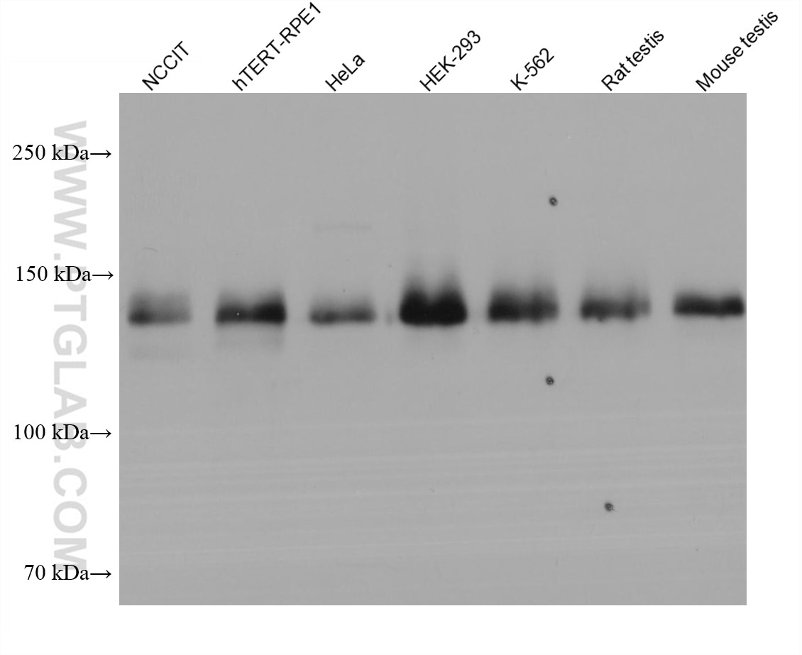Western Blot (WB) analysis of various lysates using NBR1 Monoclonal antibody (68062-1-Ig)