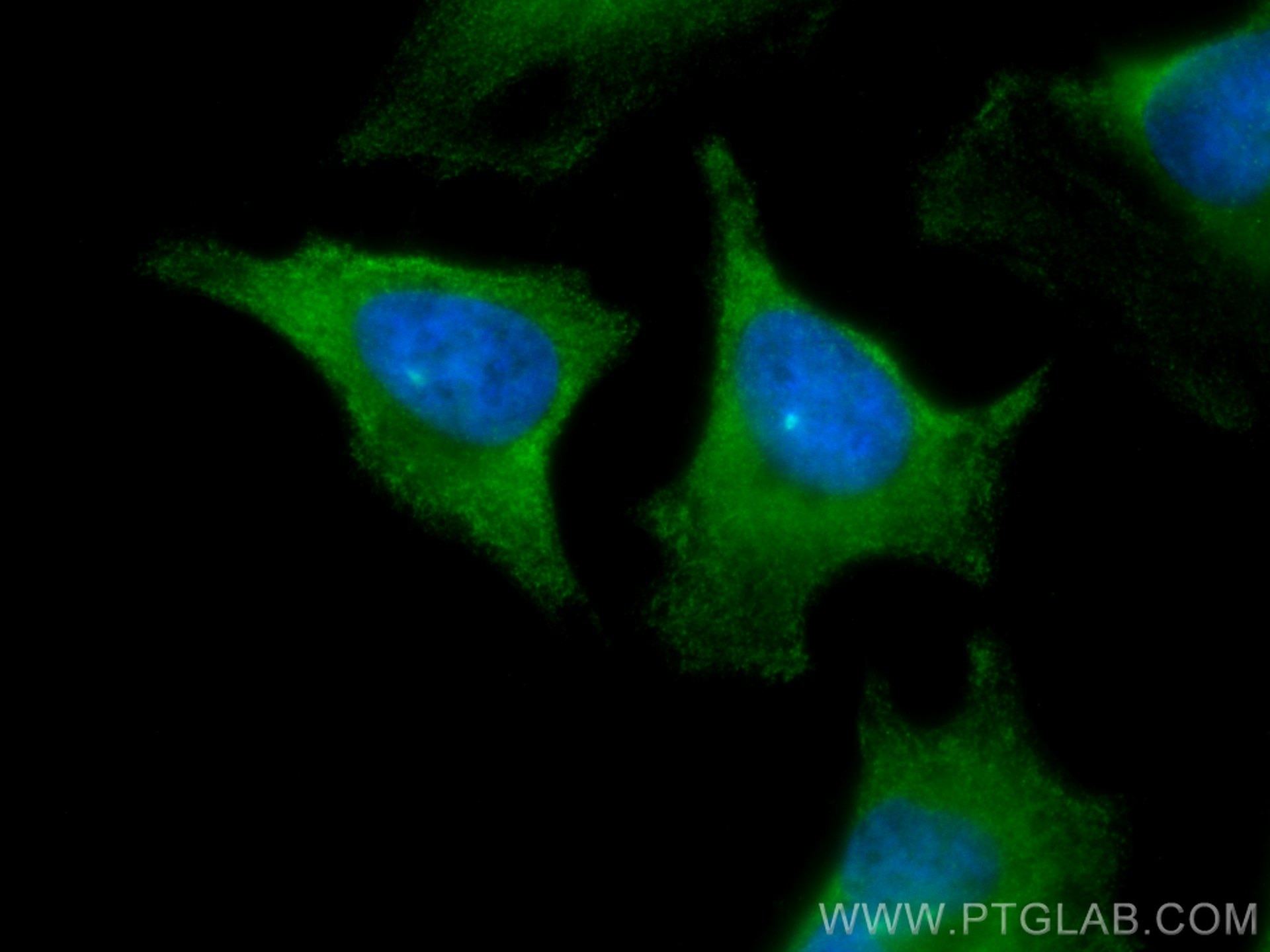Immunofluorescence (IF) / fluorescent staining of HeLa cells using CoraLite® Plus 488-conjugated NBR1 Polyclonal anti (CL488-16004)