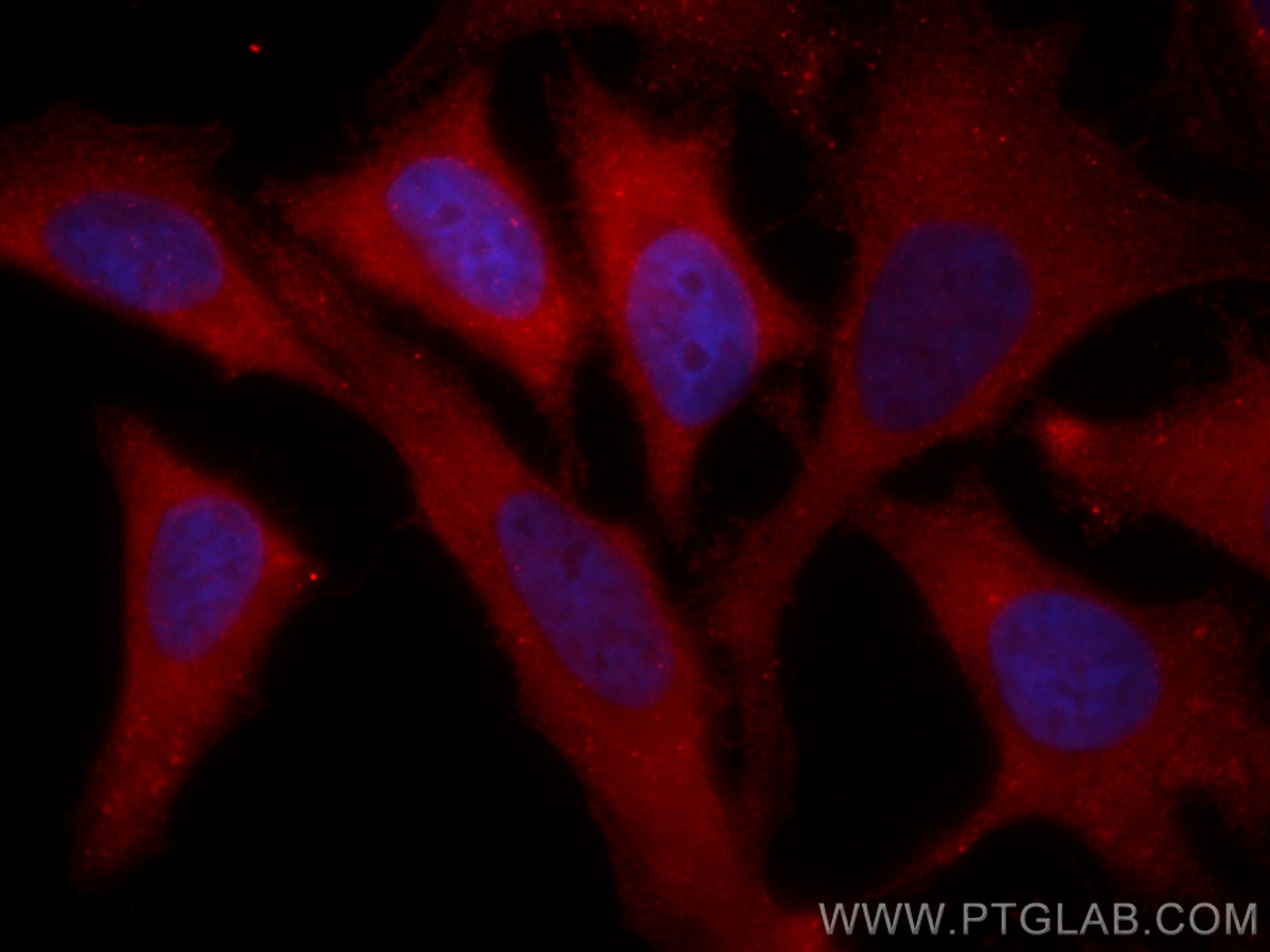 Immunofluorescence (IF) / fluorescent staining of HeLa cells using CoraLite®594-conjugated NBR1 Polyclonal antibody (CL594-16004)