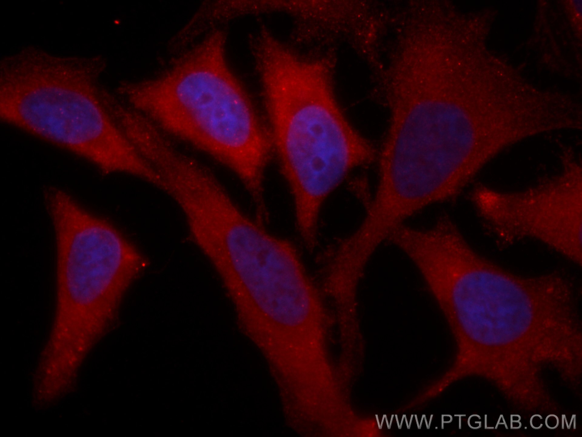 IF Staining of HeLa using CL594-16004