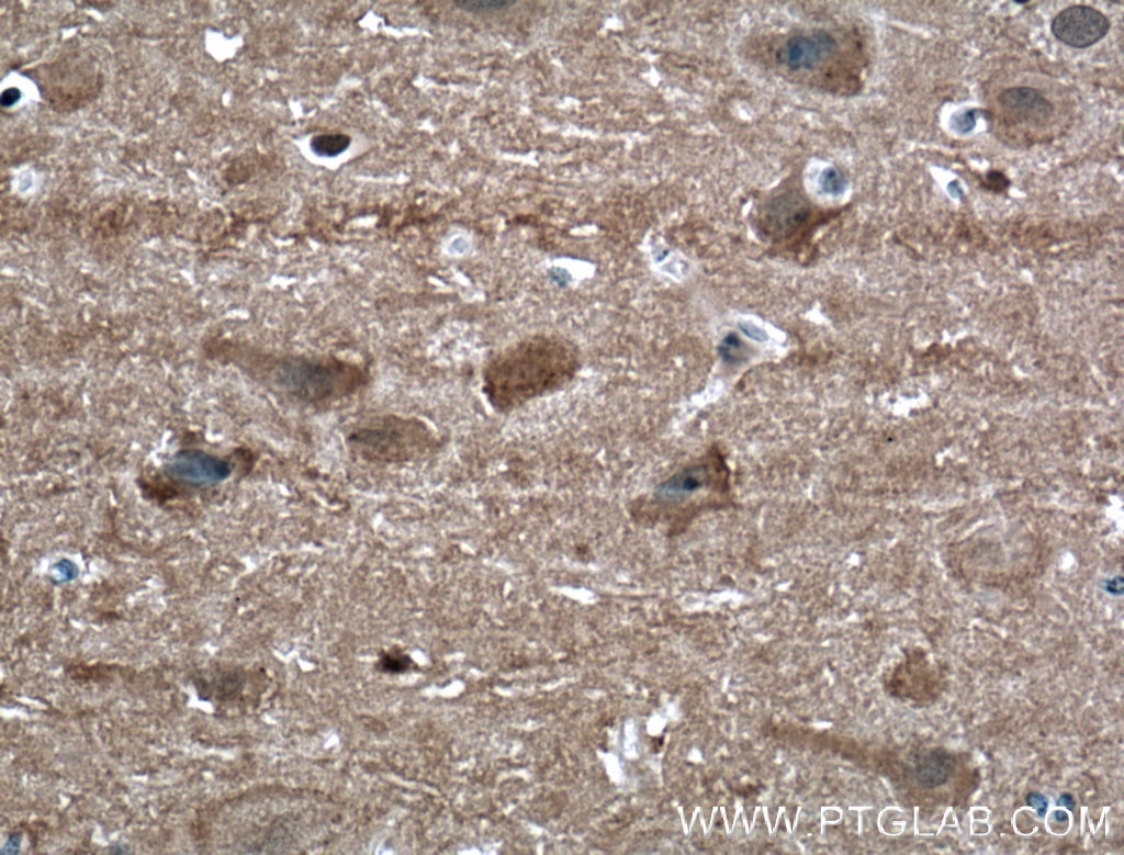 Immunohistochemistry (IHC) staining of human brain tissue using NCALD Polyclonal antibody (12925-1-AP)