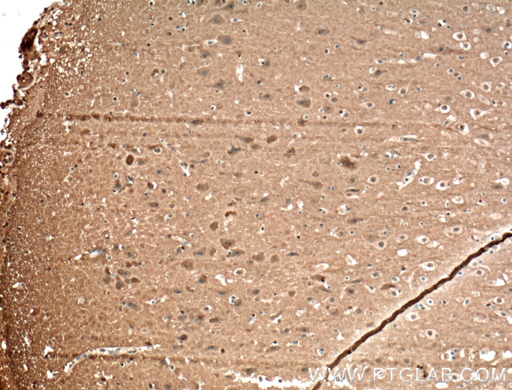 Immunohistochemistry (IHC) staining of human brain tissue using NCALD Polyclonal antibody (12925-1-AP)