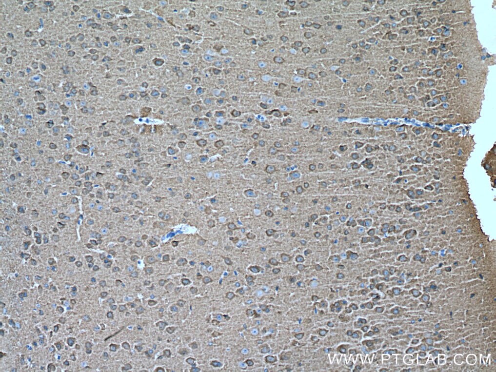 Immunohistochemistry (IHC) staining of mouse brain tissue using NCALD Polyclonal antibody (12925-1-AP)