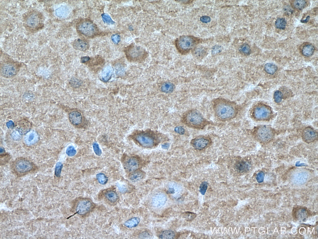 Immunohistochemistry (IHC) staining of mouse brain tissue using NCALD Polyclonal antibody (12925-1-AP)