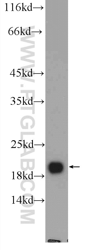Western Blot (WB) analysis of rat brain tissue using NCALD Polyclonal antibody (12925-1-AP)