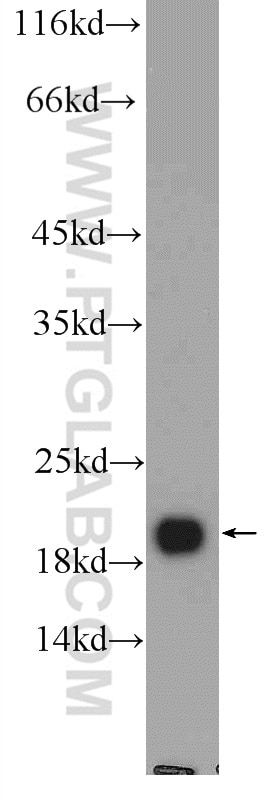 WB analysis of rat brain using 12925-1-AP