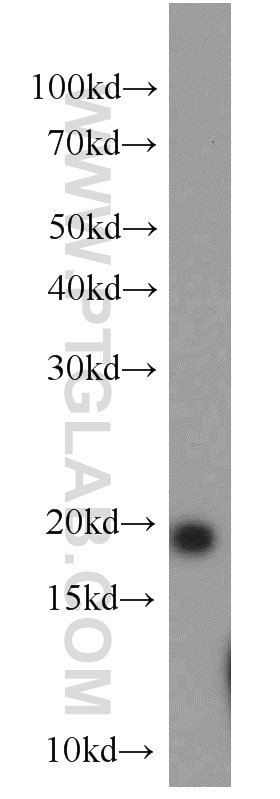 Western Blot (WB) analysis of mouse brain tissue using NCALD Polyclonal antibody (12925-1-AP)