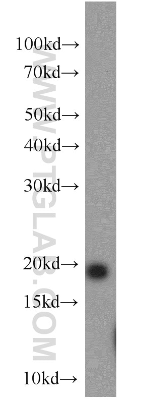 Western Blot (WB) analysis of mouse brain tissue using NCALD Polyclonal antibody (12925-1-AP)
