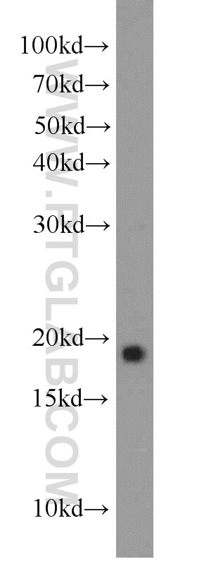 WB analysis of mouse cerebellum using 12925-1-AP