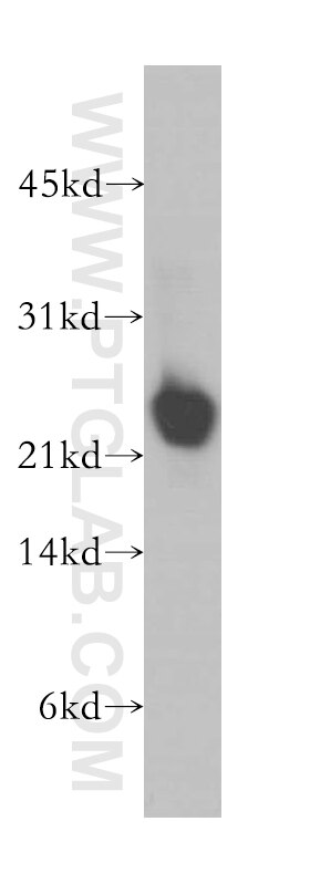 Western Blot (WB) analysis of human brain tissue using NCALD Polyclonal antibody (12925-1-AP)