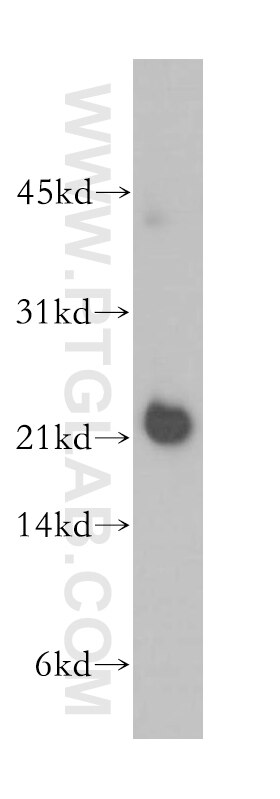 Western Blot (WB) analysis of human heart tissue using NCALD Polyclonal antibody (12925-1-AP)