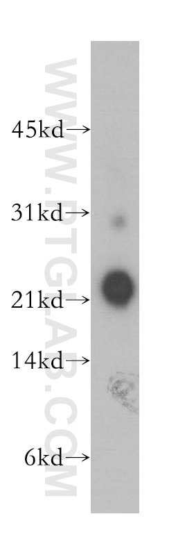 Western Blot (WB) analysis of human cerebellum tissue using NCALD Polyclonal antibody (12925-1-AP)