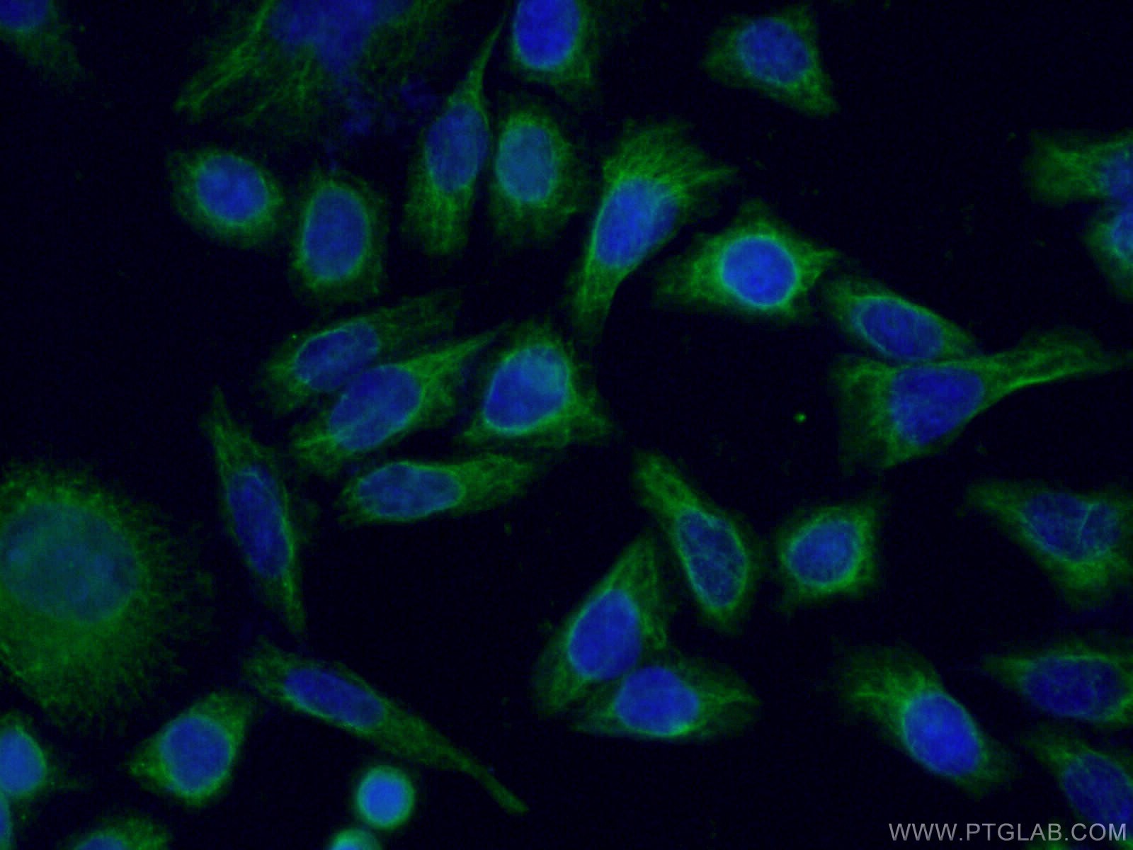 Immunofluorescence (IF) / fluorescent staining of HeLa cells using NCALD Monoclonal antibody (66088-1-Ig)