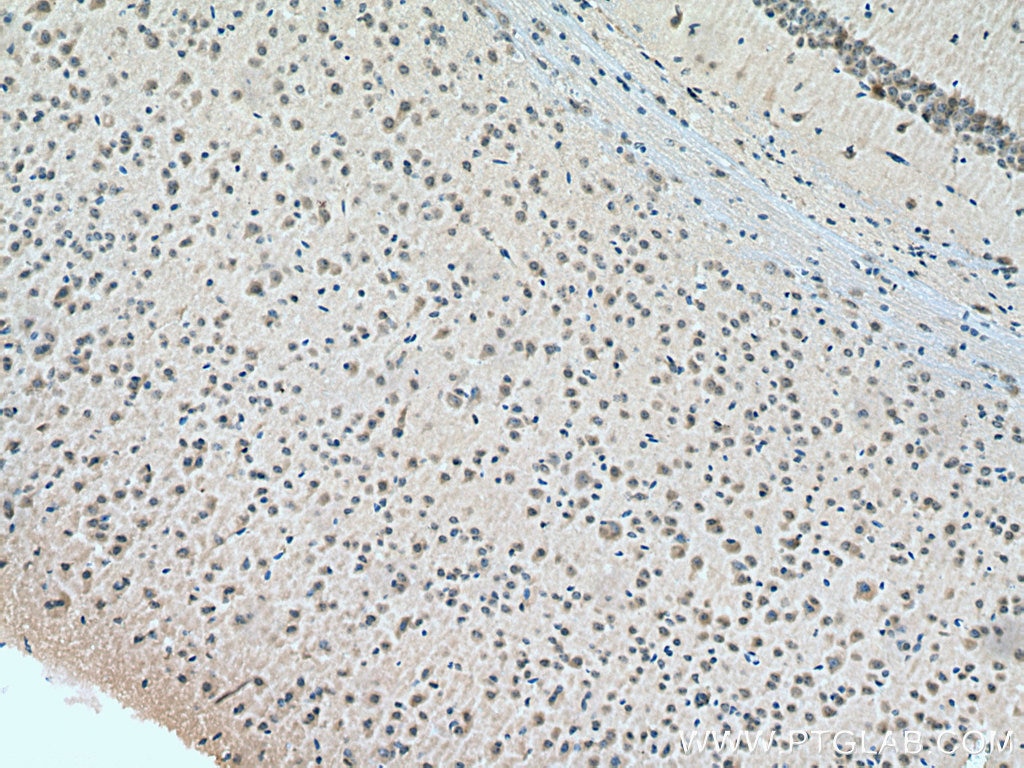 Immunohistochemistry (IHC) staining of mouse brain tissue using NCALD Monoclonal antibody (66088-1-Ig)