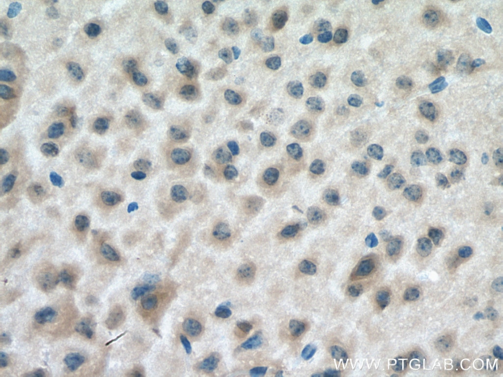 Immunohistochemistry (IHC) staining of mouse brain tissue using NCALD Monoclonal antibody (66088-1-Ig)