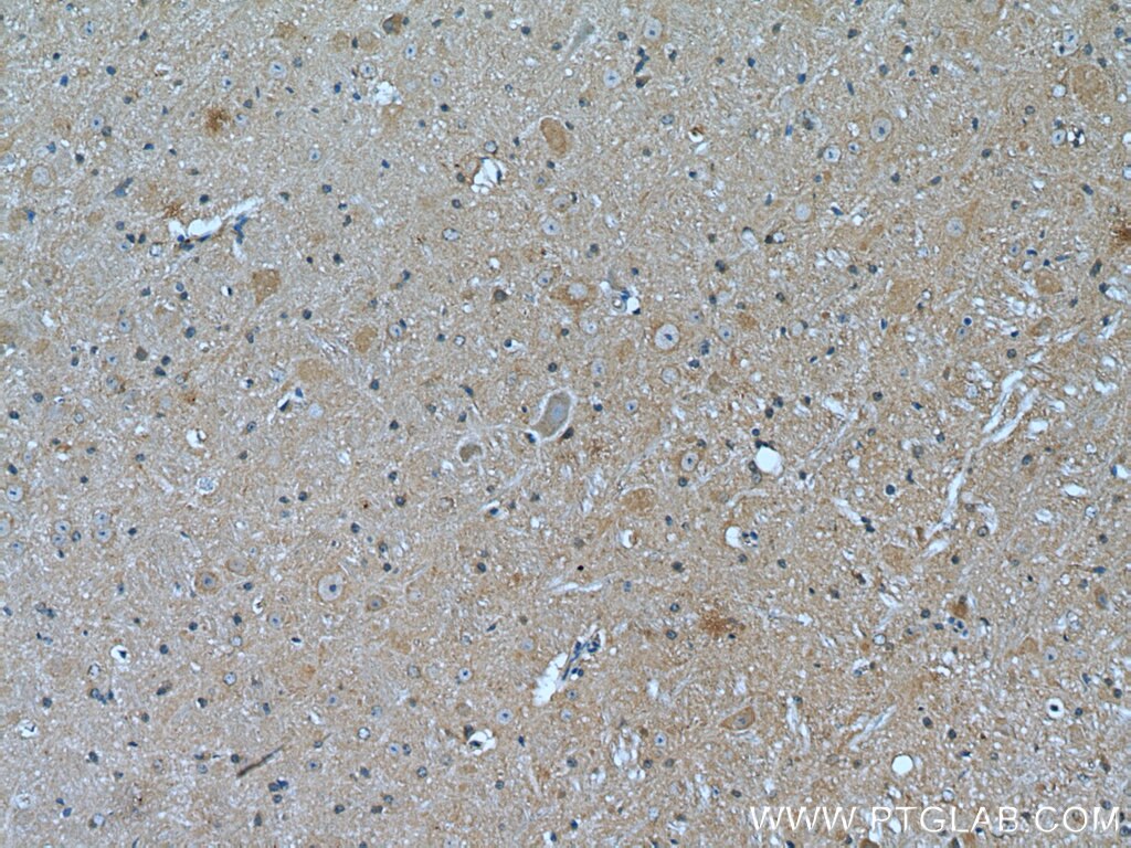 IHC staining of mouse cerebellum using 66088-1-Ig