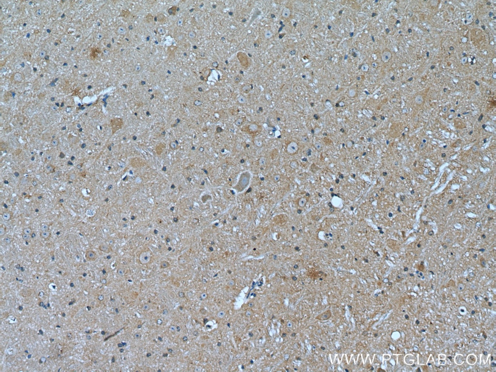 Immunohistochemistry (IHC) staining of mouse cerebellum tissue using NCALD Monoclonal antibody (66088-1-Ig)