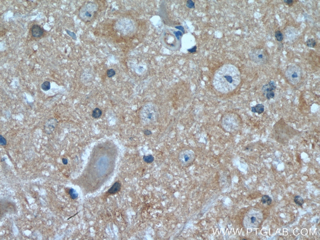 Immunohistochemistry (IHC) staining of mouse cerebellum tissue using NCALD Monoclonal antibody (66088-1-Ig)