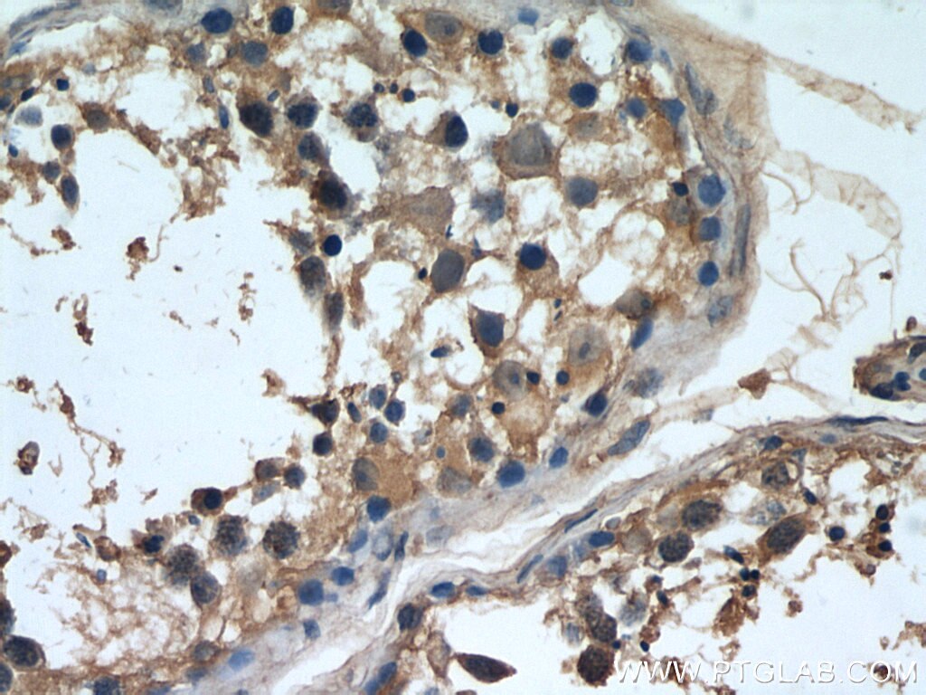 Immunohistochemistry (IHC) staining of human testis tissue using NCALD Monoclonal antibody (66088-1-Ig)