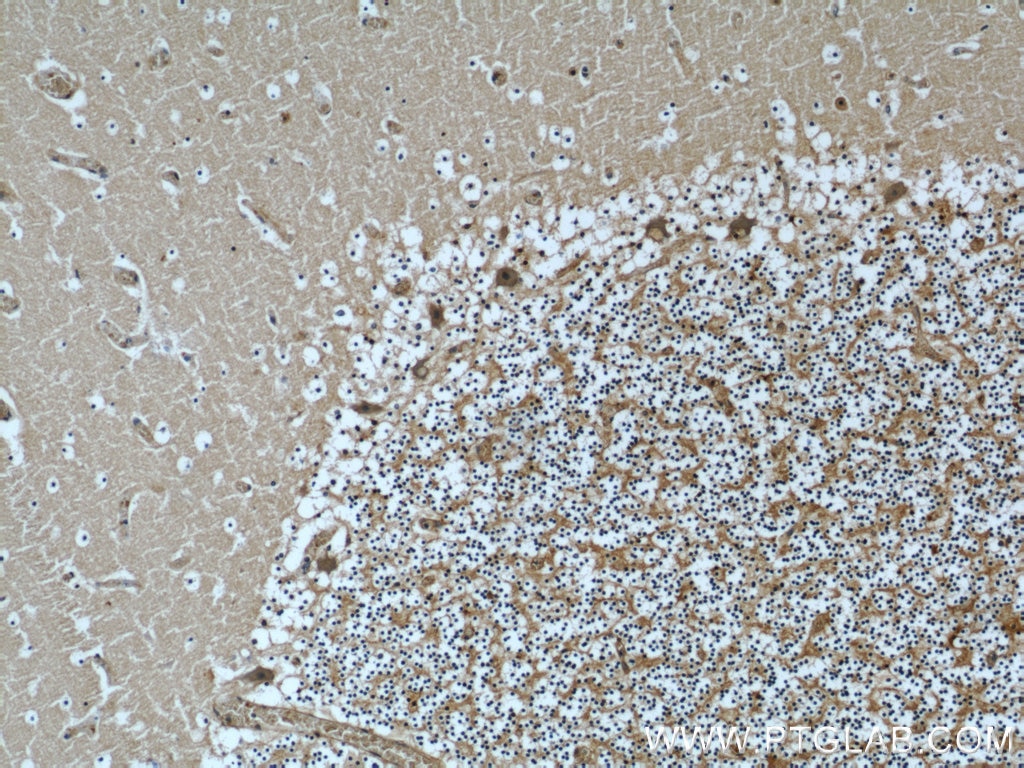 IHC staining of human cerebellum using 66088-1-Ig