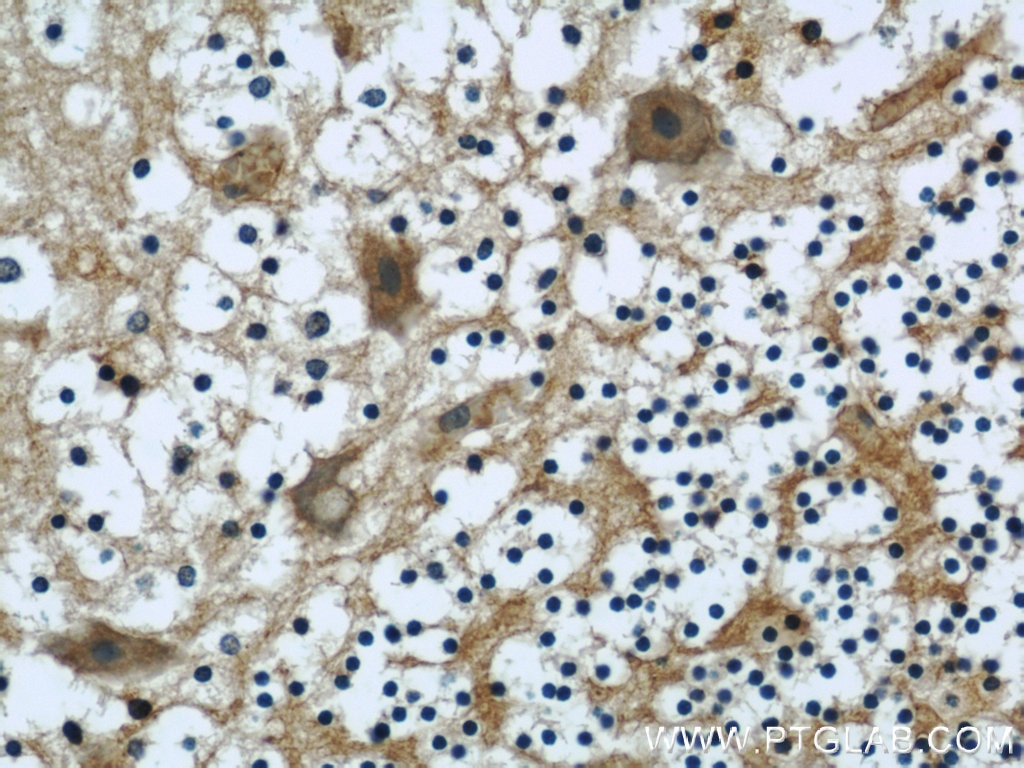 Immunohistochemistry (IHC) staining of human cerebellum tissue using NCALD Monoclonal antibody (66088-1-Ig)