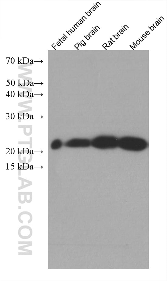 Western Blot (WB) analysis of various lysates using NCALD Monoclonal antibody (66088-1-Ig)