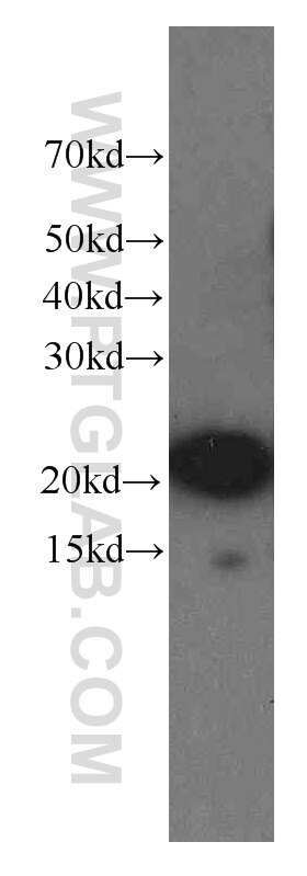 Western Blot (WB) analysis of human brain tissue using NCALD Monoclonal antibody (66088-1-Ig)
