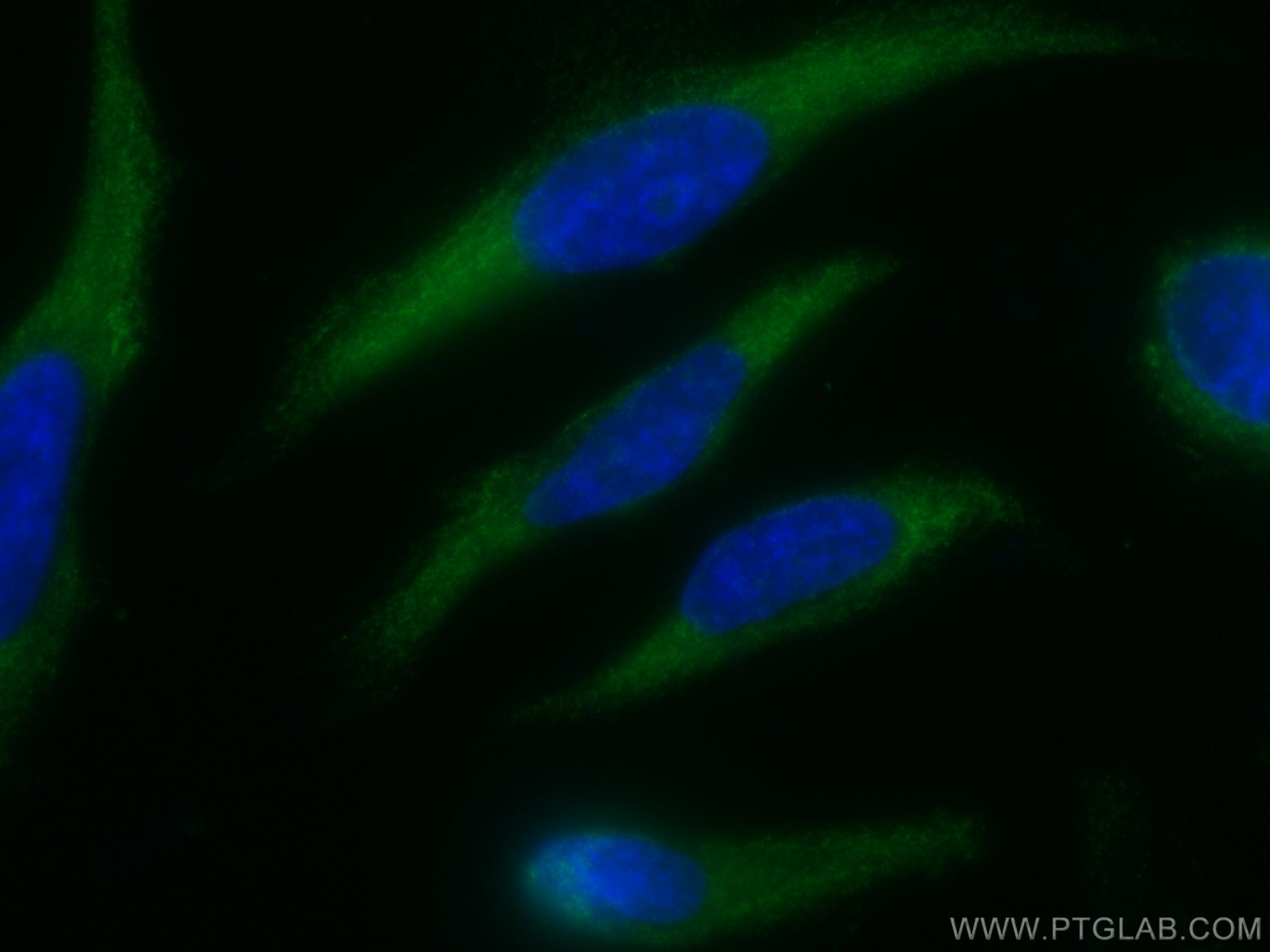 Immunofluorescence (IF) / fluorescent staining of HeLa cells using CoraLite® Plus 488-conjugated NCALD Monoclonal ant (CL488-66088)