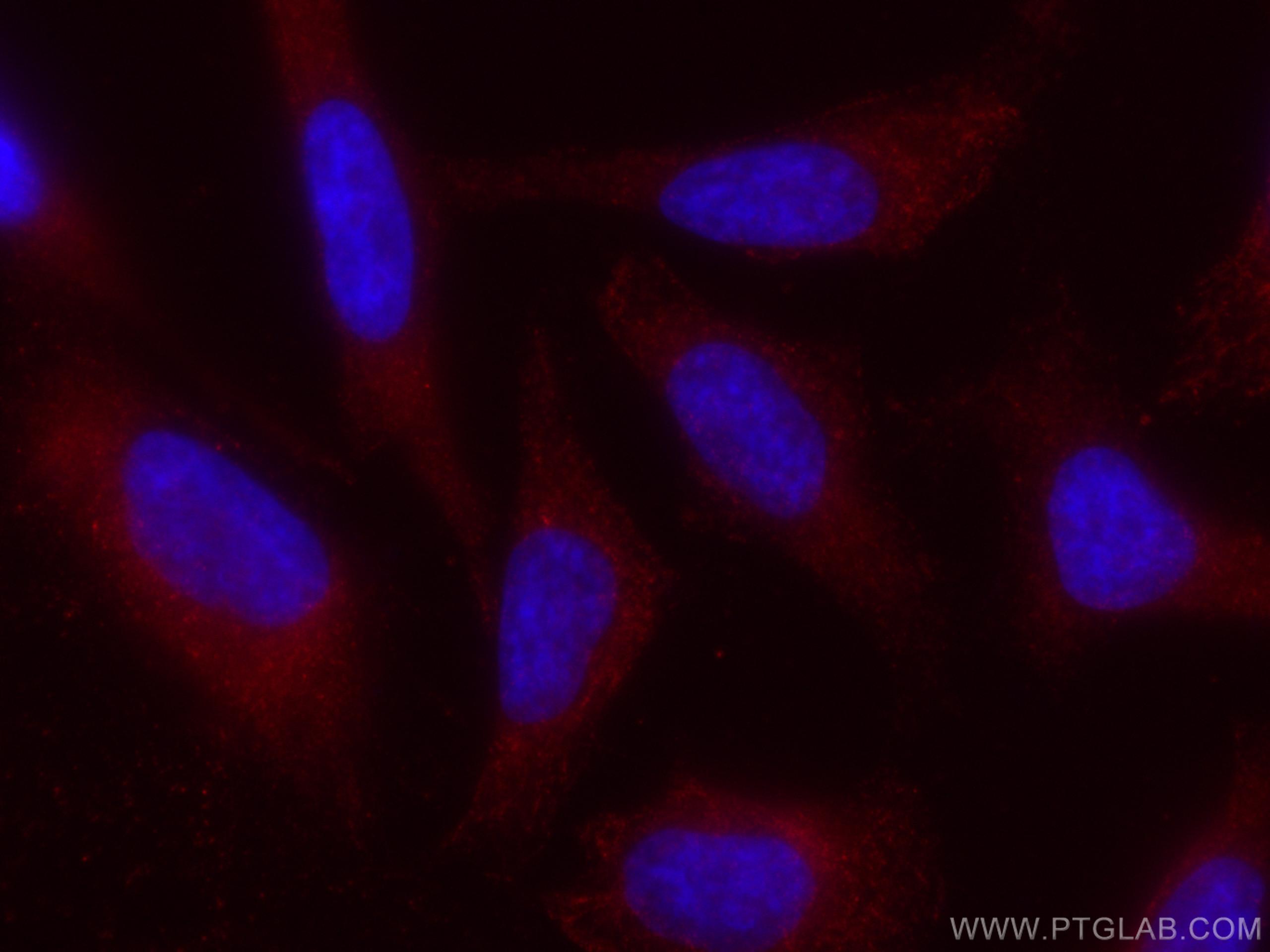 Immunofluorescence (IF) / fluorescent staining of HeLa cells using CoraLite®594-conjugated NCALD Monoclonal antibody (CL594-66088)