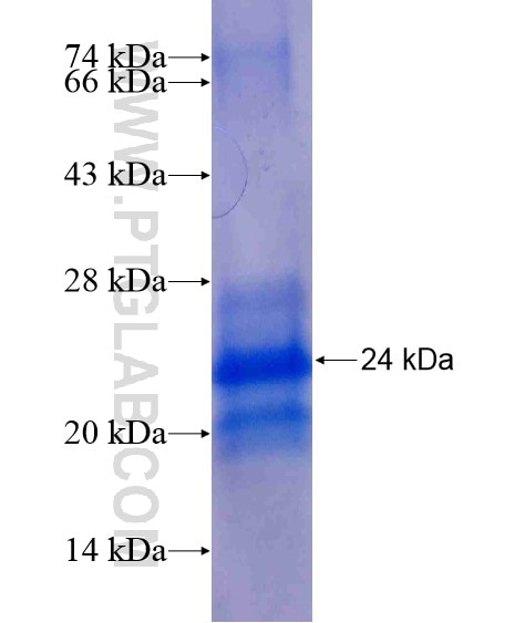 NCALD fusion protein Ag18760 SDS-PAGE