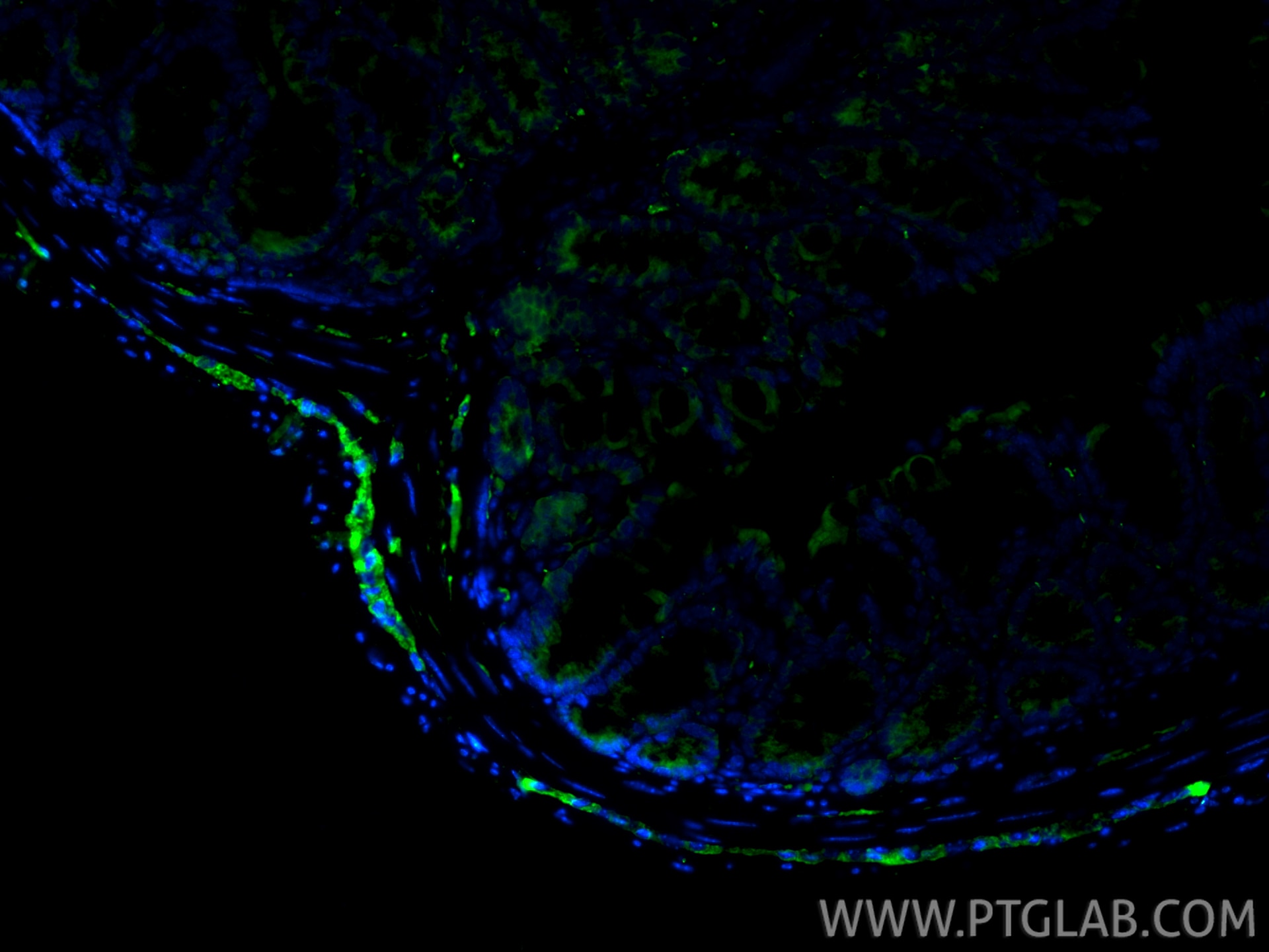Immunofluorescence (IF) / fluorescent staining of mouse colon tissue using NCAM1/CD56 Polyclonal antibody (14255-1-AP)