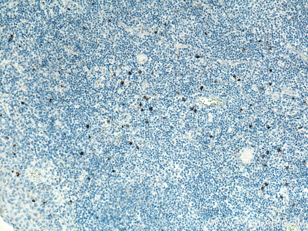 Immunohistochemistry (IHC) staining of human tonsillitis tissue using NCAM1/CD56 Polyclonal antibody (14255-1-AP)