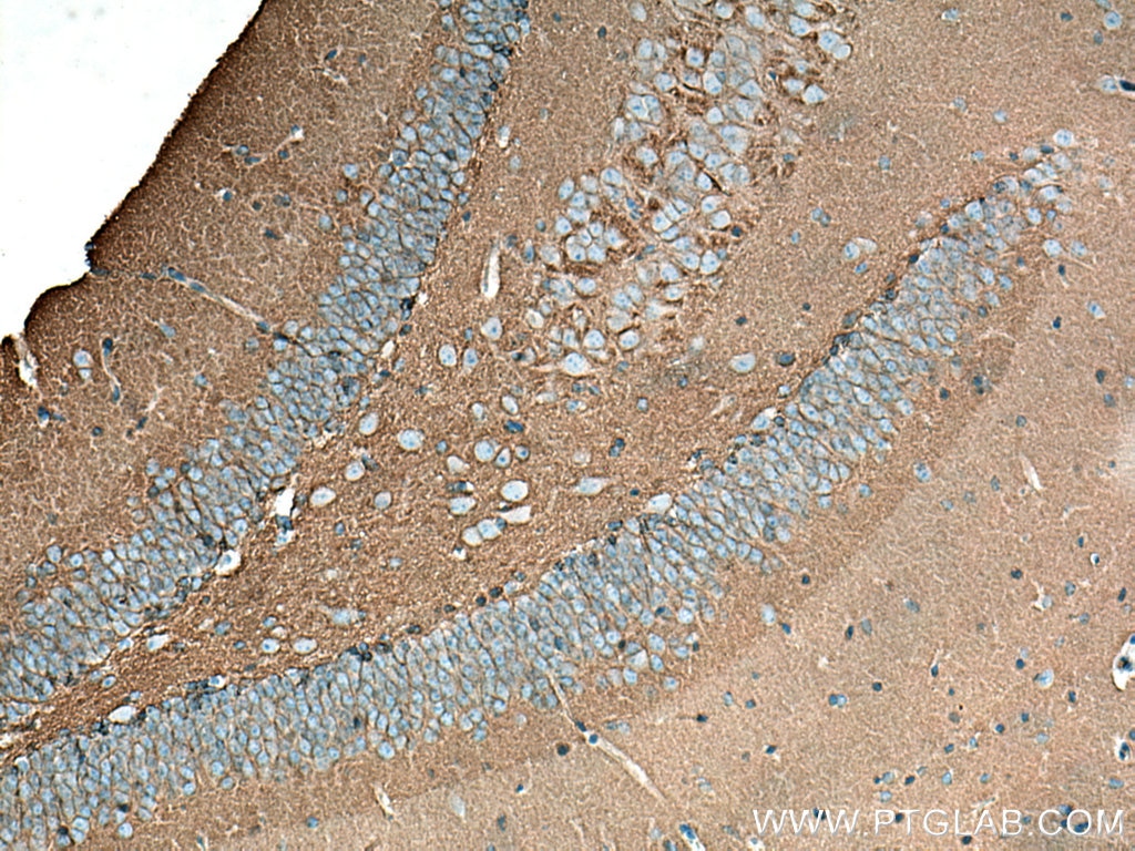 Immunohistochemistry (IHC) staining of mouse brain tissue using NCAM1/CD56 Polyclonal antibody (14255-1-AP)