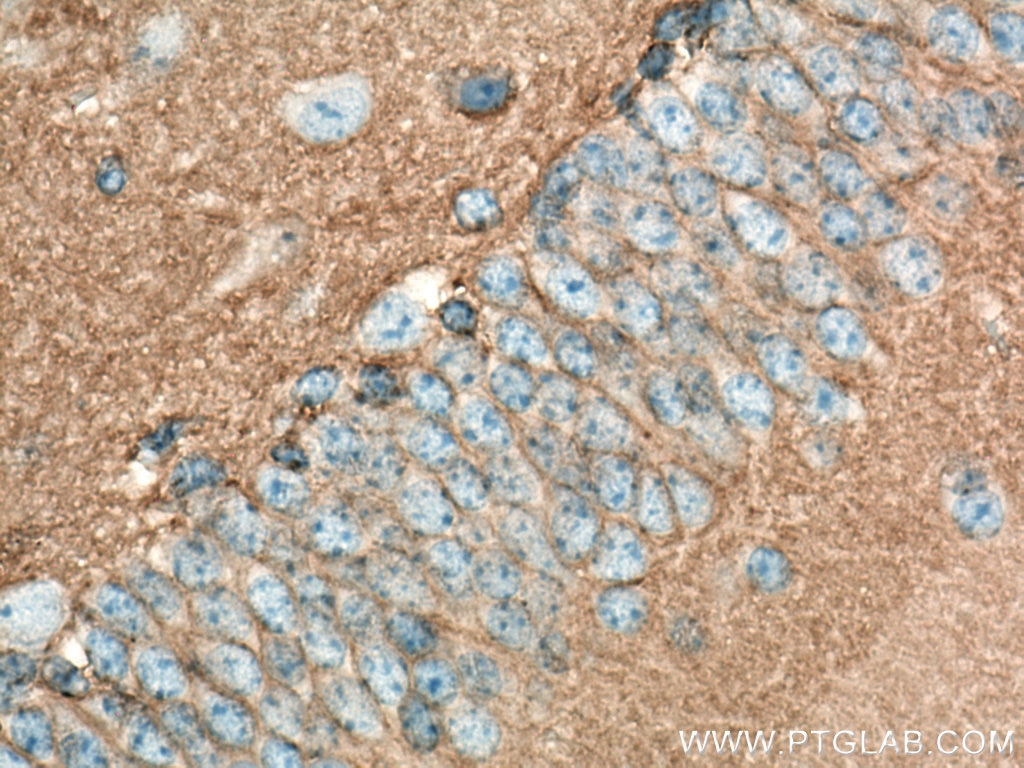Immunohistochemistry (IHC) staining of mouse brain tissue using NCAM1/CD56 Polyclonal antibody (14255-1-AP)