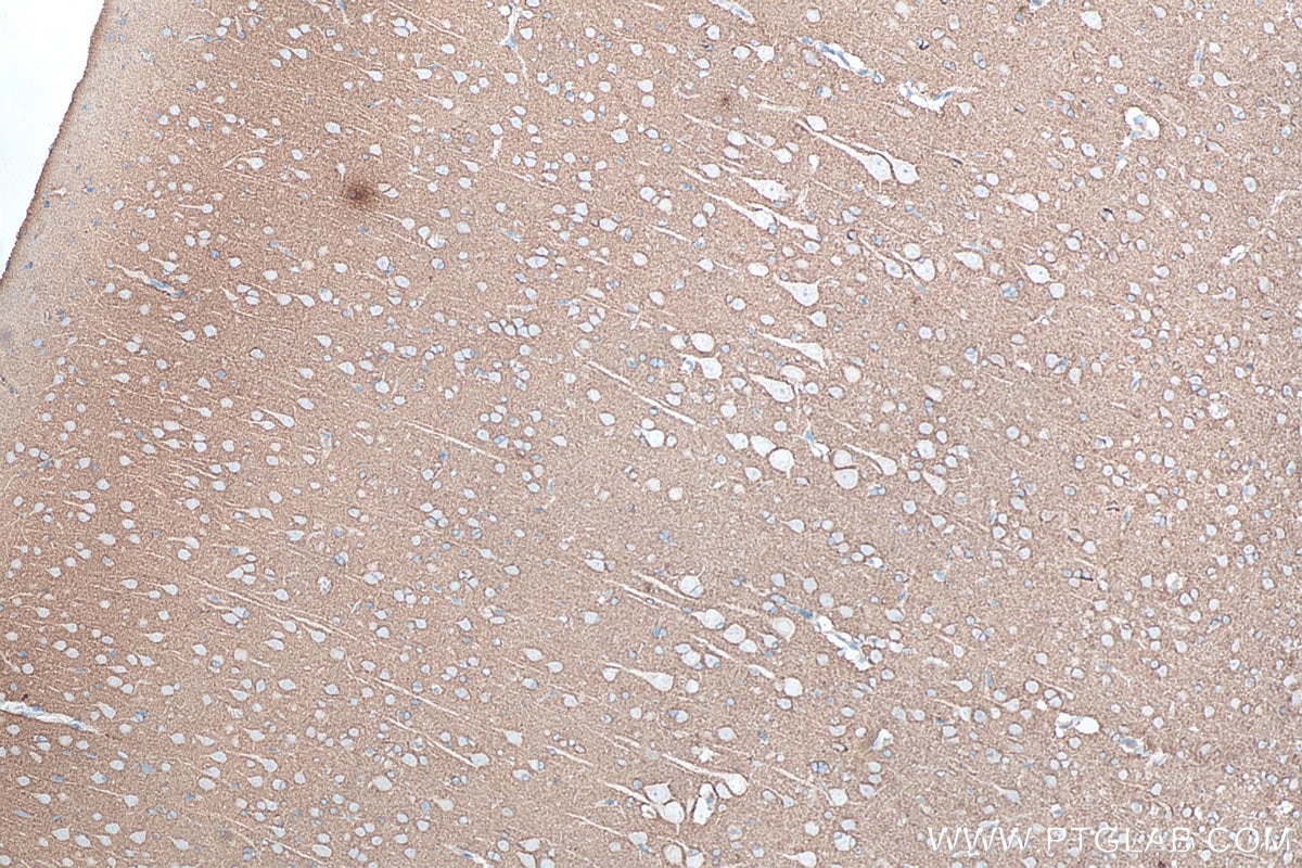 Immunohistochemistry (IHC) staining of rat brain tissue using NCAM1/CD56 Polyclonal antibody (14255-1-AP)