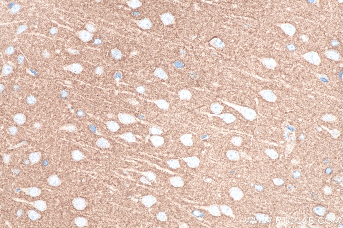 Immunohistochemistry (IHC) staining of rat brain tissue using NCAM1/CD56 Polyclonal antibody (14255-1-AP)