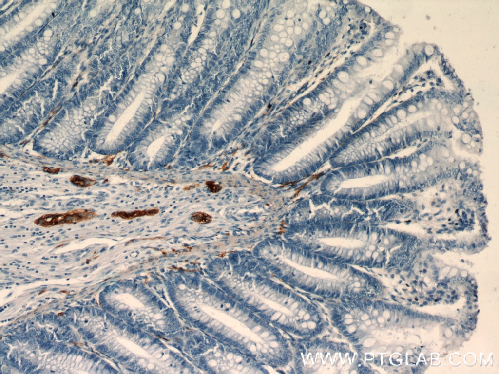 IHC staining of human colon using 14255-1-AP